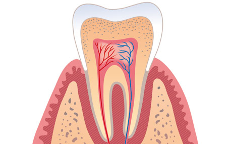 Zur Vorbeugung von Zahnerkrankungen tragen mehrere Faktoren bei: eine gründliche und regelmäßige Pflege der Zähne und Zahnzwischenräume, eine zahngesunde Ernährung sowie die regelmäßige Kontrolle des Zustands der Zähne und des Zahnfleischs durch den Zahnarzt.